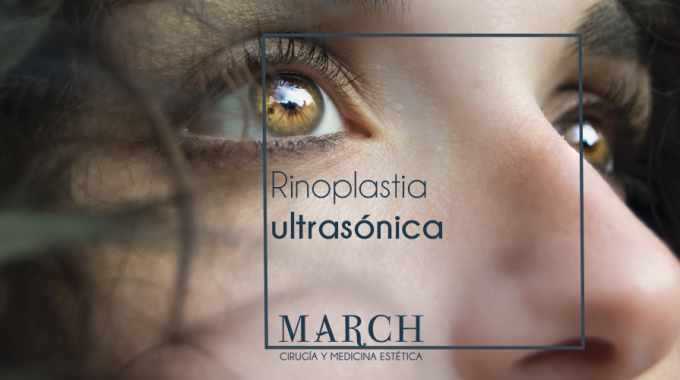 Rinoplastia Ultrasonica March