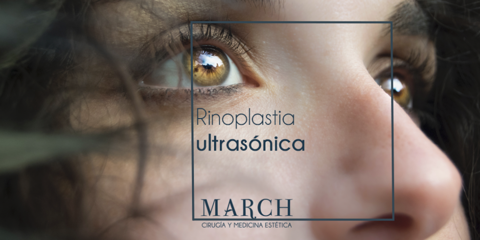 Rinoplastia Ultrasonica March