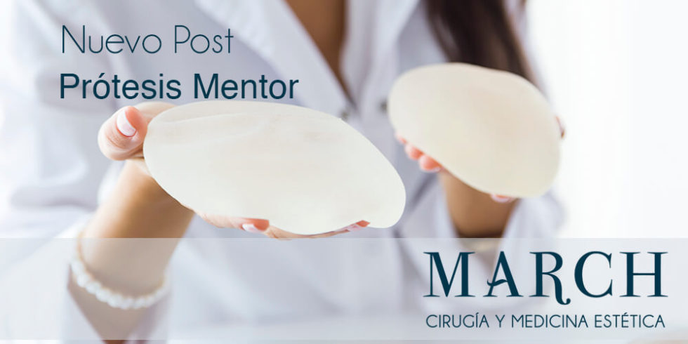 lechuga cruzar entregar Prótesis Mentor | Aumento de pecho | Clínica March Marbella