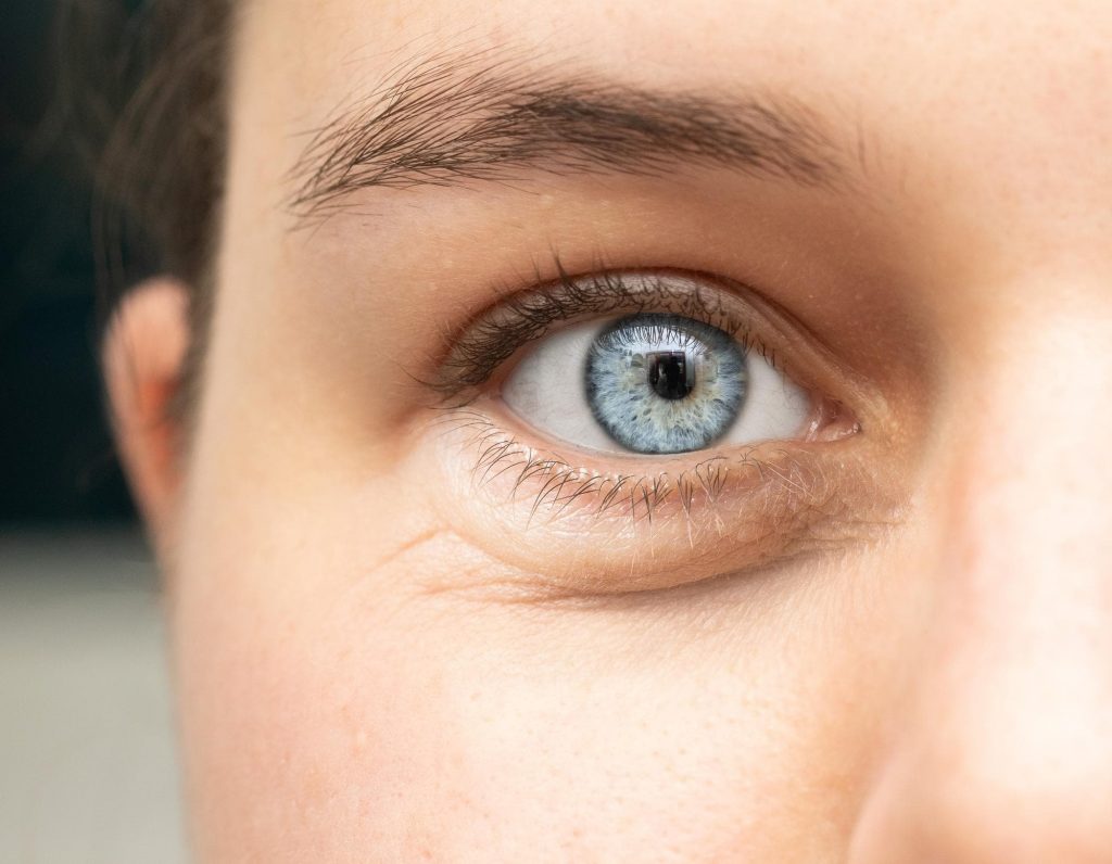 blefaroplastia-marbella