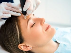 Mesoterapia facial aplicacion cara