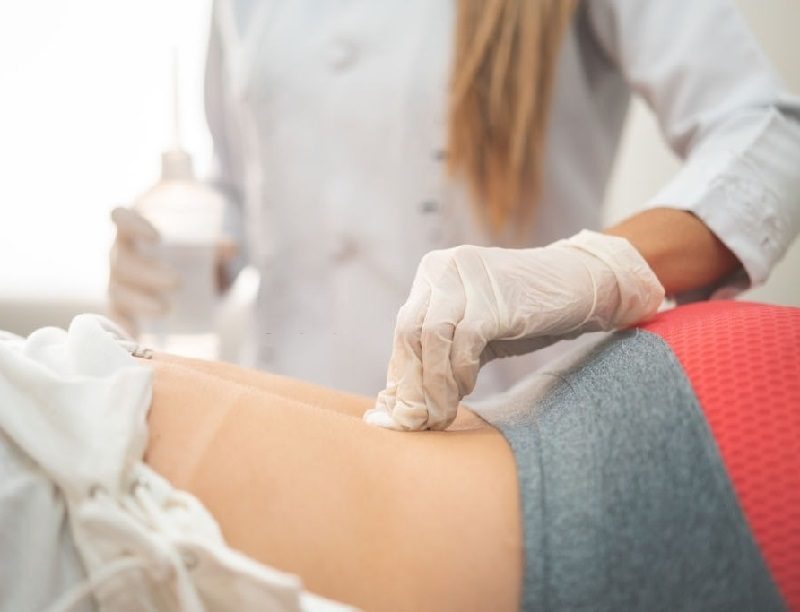 Sesión de mesoterapia corporal