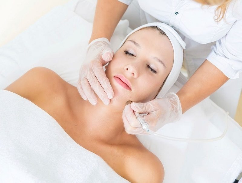 Microdermoabrasión en Marbella